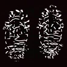 Radis Noir - Pub Nordique